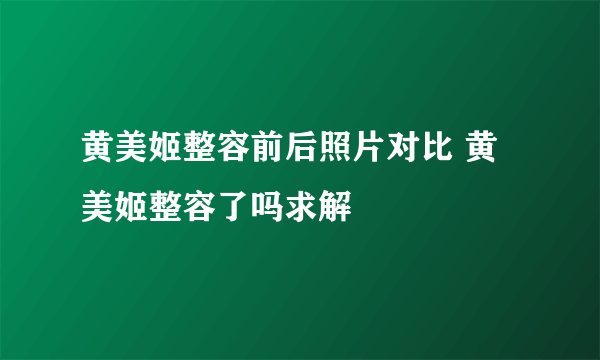 黄美姬整容前后照片对比 黄美姬整容了吗求解