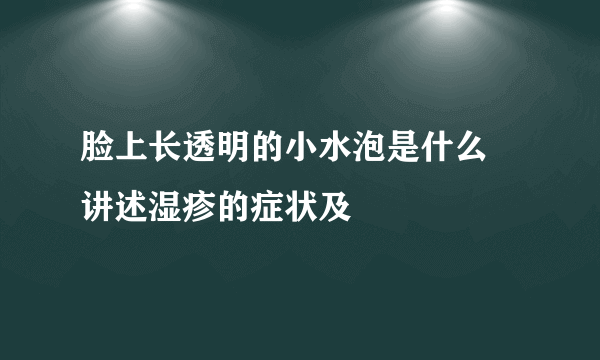 脸上长透明的小水泡是什么 讲述湿疹的症状及