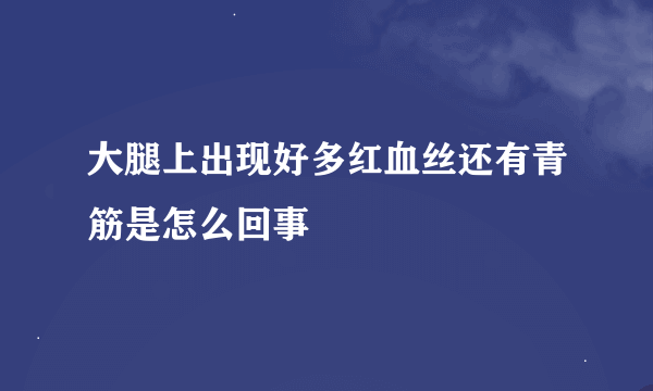 大腿上出现好多红血丝还有青筋是怎么回事