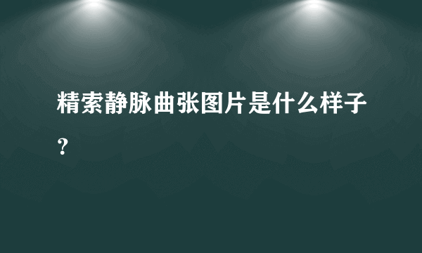 精索静脉曲张图片是什么样子？