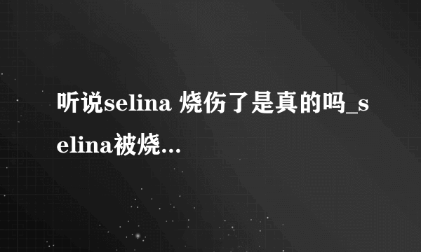 听说selina 烧伤了是真的吗_selina被烧伤视频_selina严重烧伤视频_selina拍戏烧伤视频