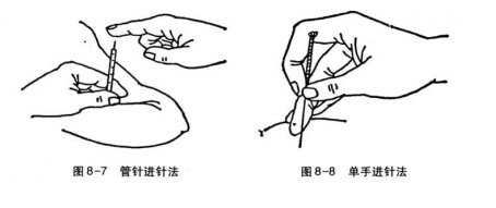 针刺方法有哪些？