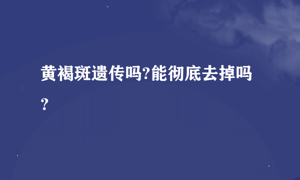 黄褐斑遗传吗?能彻底去掉吗？