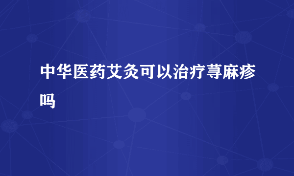 中华医药艾灸可以治疗荨麻疹吗