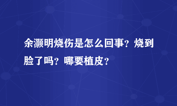 余灏明烧伤是怎么回事？烧到脸了吗？哪要植皮？