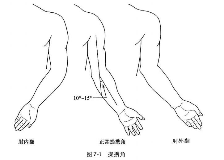 肘外翻导致不能当兵了