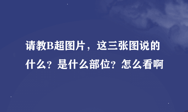 请教B超图片，这三张图说的什么？是什么部位？怎么看啊